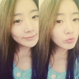 수빈 근황, 교통사고 후 근황 "많이 보고 싶네요"