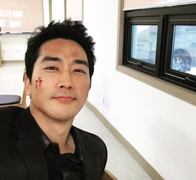 송승헌, 상처 투성이 얼굴…"굿모닝 이라고요?"